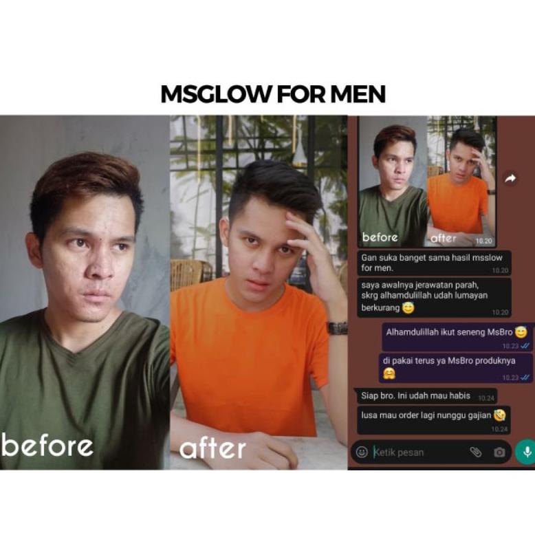 MS GLOW FOR MEN ORIGINAL PAKET WAJAH PRIA LENGKAP | PAKET MS GLOW FOR MEN