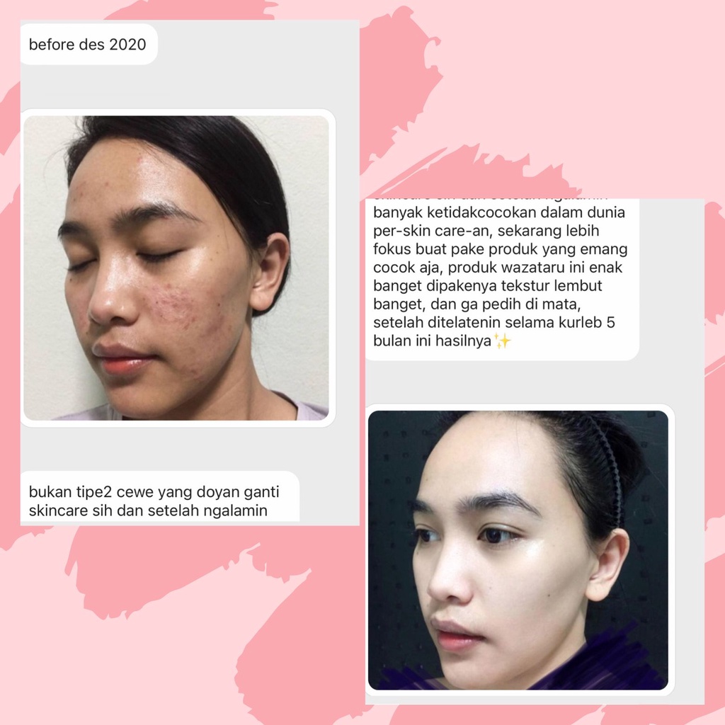 MASKER WAJAH GLOWING - Masker Pengelupasan - Serum Pengelupasan - Chemical Peeling Klinik by WAZATARU