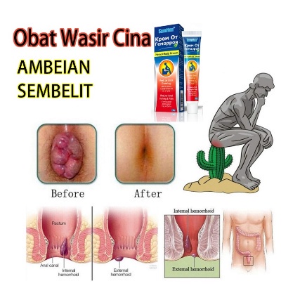 Sumifun Dictamni Hemorhoid Cream 20g - Wasir Ambeien Krim Wasir Salep Ambeien 100% Original Sembuh Wasir Tanpa Operasi Salep Wasir Ambeien Dan Susah BAB