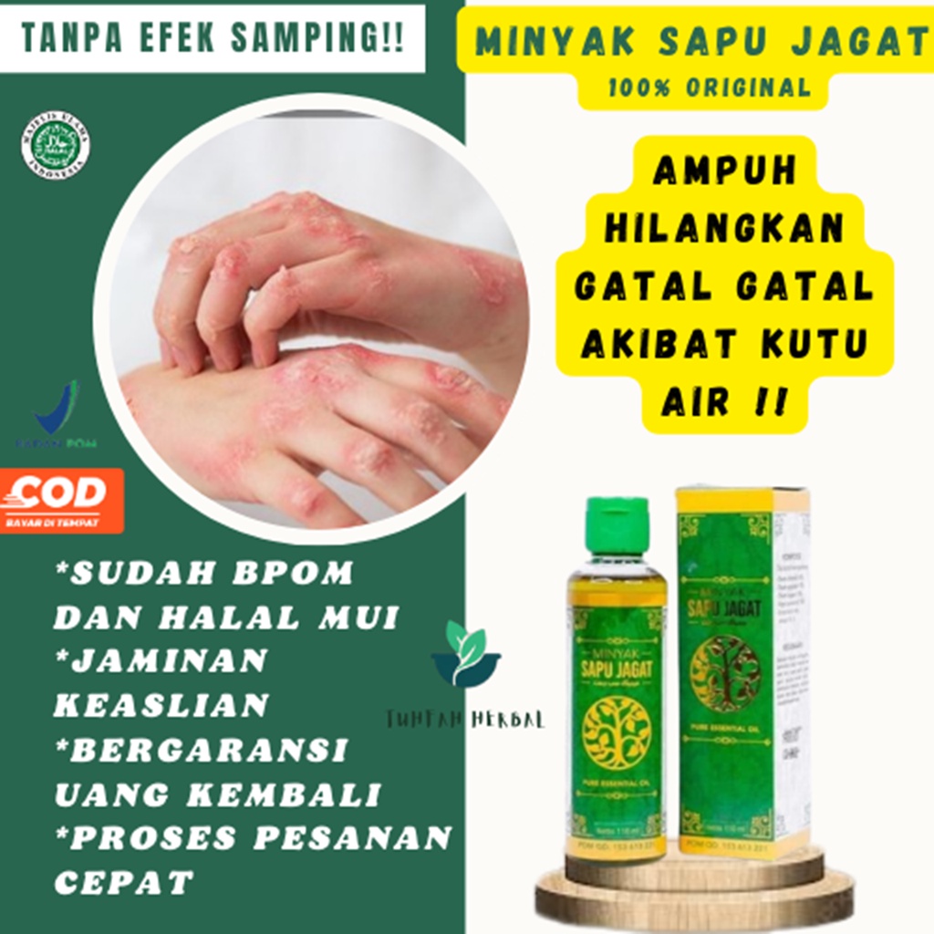Obat Gatal Kutu Air Kuman Air Jamur Kutu Air Kutu Air di Badan Kutu Air Tangan dan Kaki Kutu Air Di 