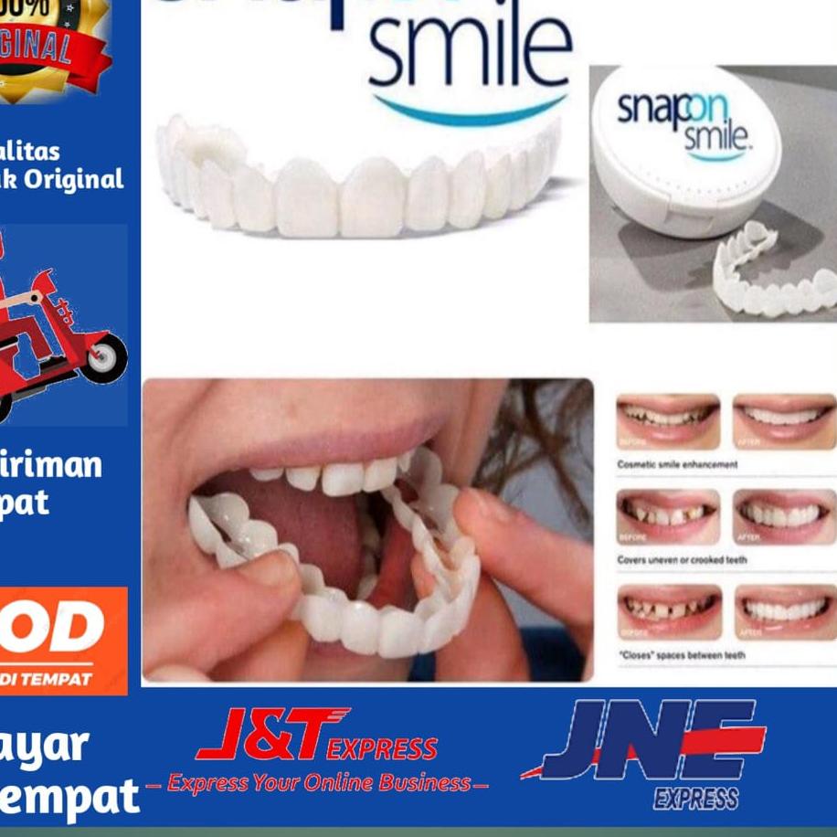 ♥ PEMUTIH GIGI INSTAN SNAP ON SMILE ORI 100% ➷