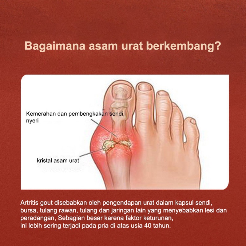 Obat Asam urat Rematik Radang Sendi Herbal 30ml Semprotan Rematik Pereda Nyeri Pada Sendi Pereda Nyeri Bunion Pengobatan Yang Efektif REMATIK ASAM URAT NYERI OTOT