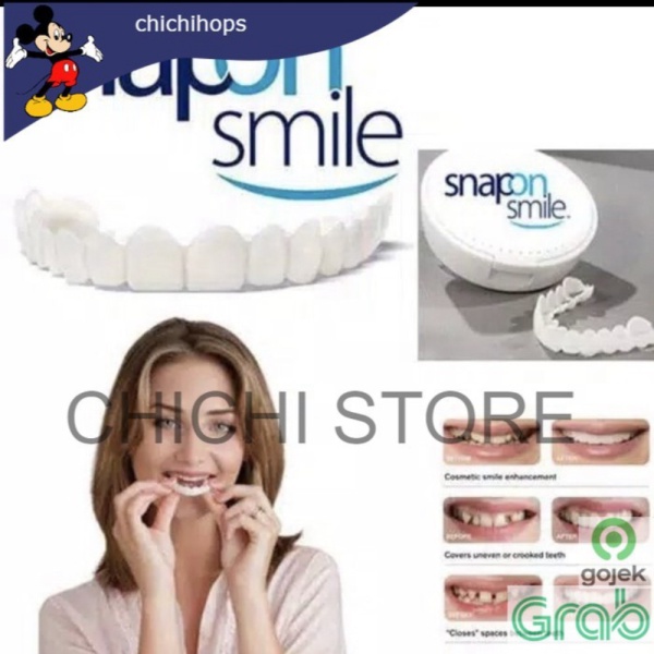 Unik Snap On Smile 100 ORIGINAL Authentic / Snap 'n Smile Gigi Palsu CC Diskon
