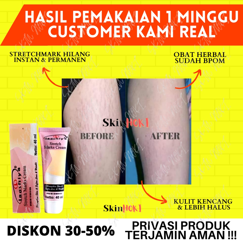 PENGHILANG STRECHMARK LAOSHIYA STRETCH MARKS CREAM ORIGINAL BPOM