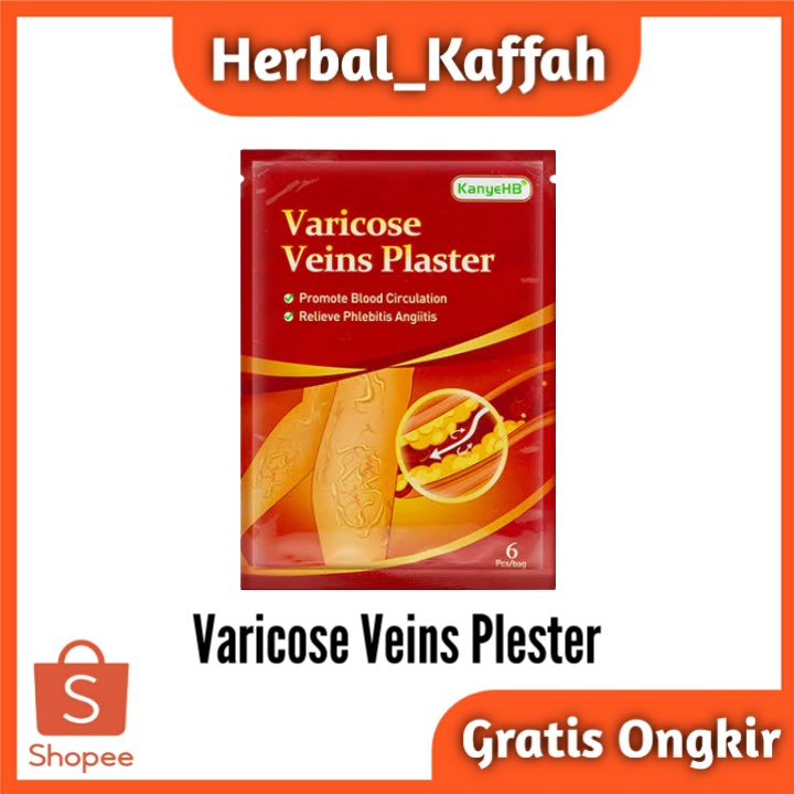 Koyo Penghilang Varises Paling Ampuh Varicose Veins Plaster Original 1pack Isi 6pcs