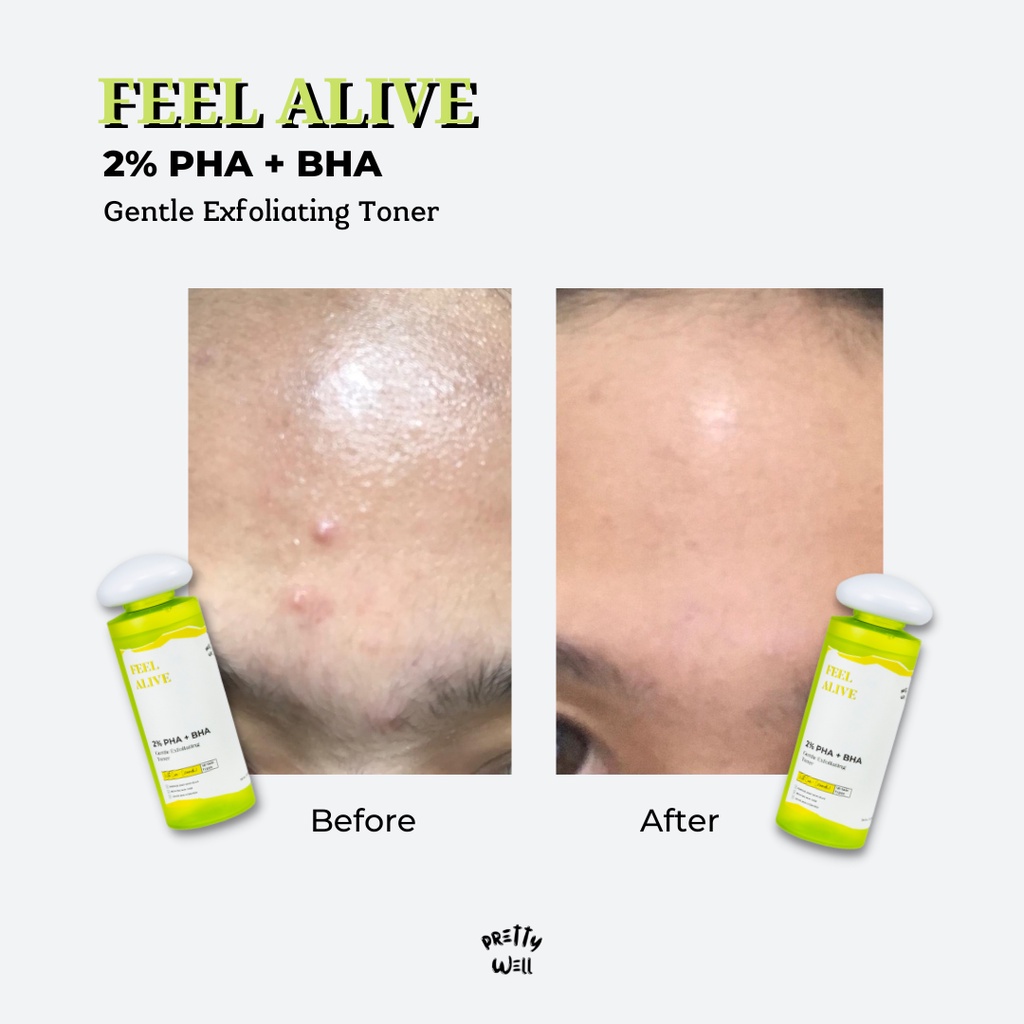 ❤ MEMEY ❤ PRETTYWELL Feel Alive 2% PHA + BHA Gentle Exfoliating Toner 100ml