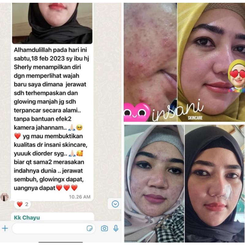 INSANI SKINCARE PAKET ACNE UNTUK JERAWAT DAN KULIT SENSITIF UV FILTER SPF 30