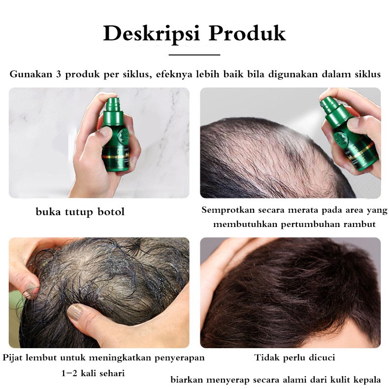 Vitamin rambut rontok Serum rambut rontok Hair tonic rambut rontok Perawatan rambut rontok 30ml Efektif membantu menumbuhkan/menguatkan rambut untuk mencegah kerontokan/membantu rambut menjadi lebih gelap dan cerah