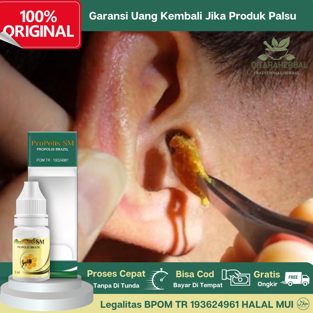 Obat Kotoran Telinga Keras, Obat Tetes Kotoran Telinga Keras, Obat Pelunak Kotoran Keras, Obat Penha