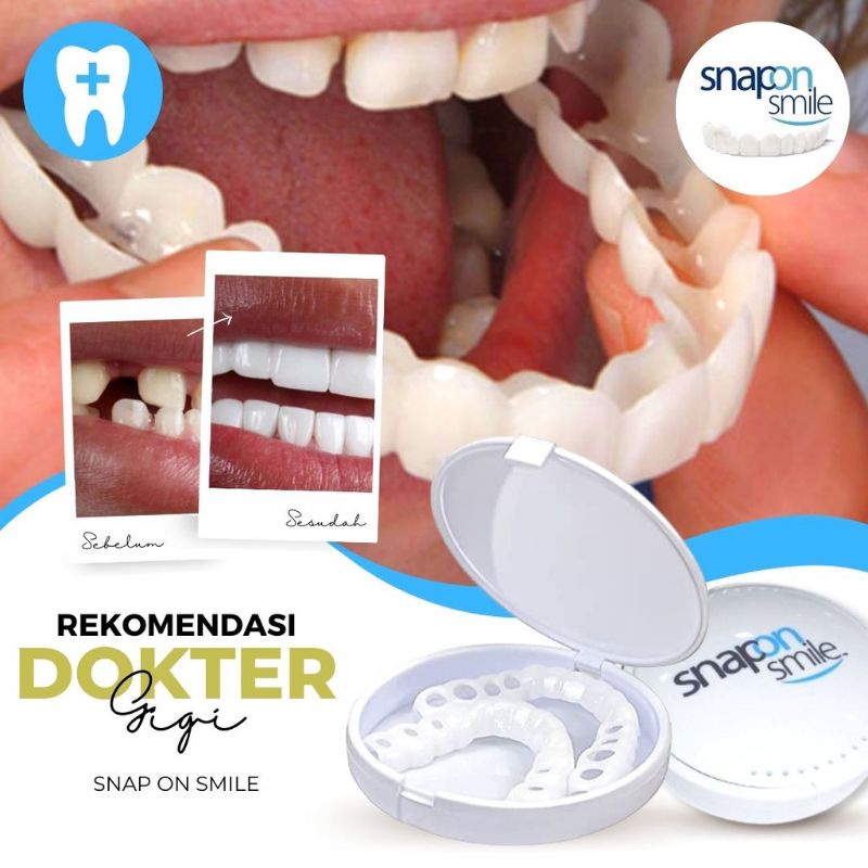 COD GIGI PALSU ATAS BAWAH ORIGINAL TERLARIS SNAP ON SMILE / Viner Gigi Instant Satu Set Atas Bawah