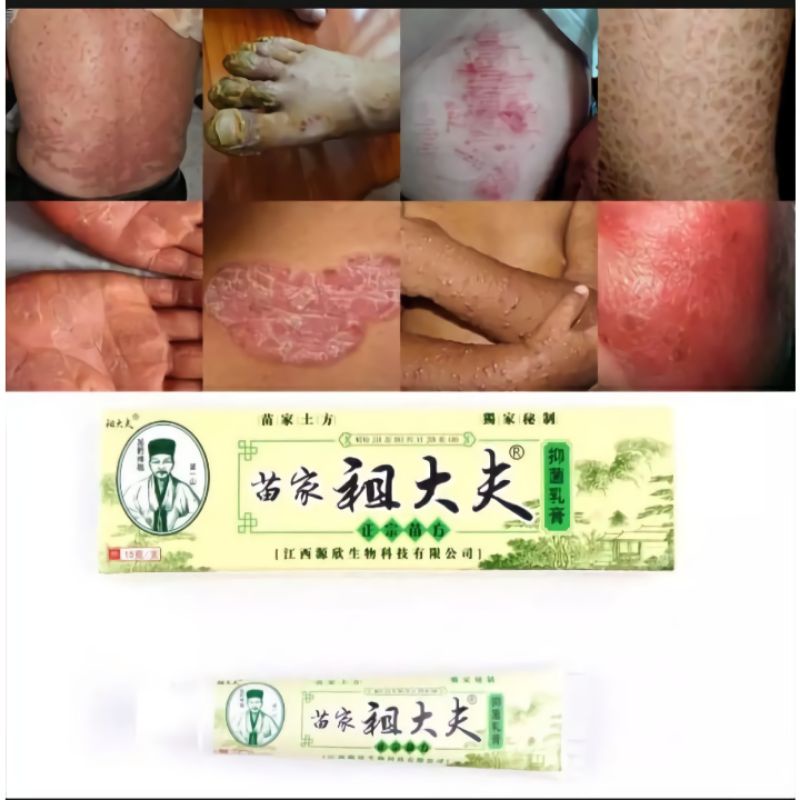 SALEP ANTI BAKTERI ORIGINAL- Eksim, Gatal, Kurap, Jamur, Psoriasis, Pruritus, Alergi