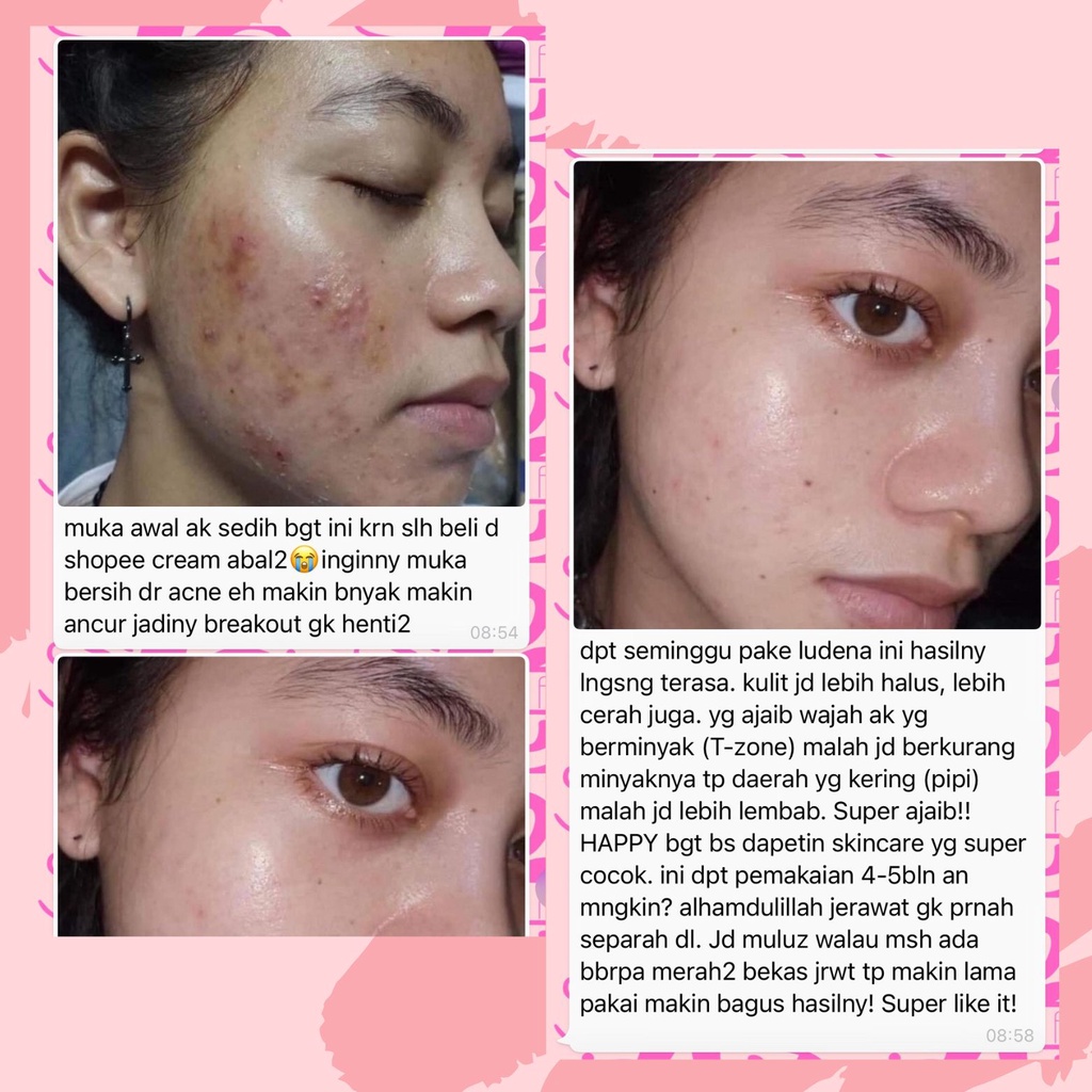 SALEP PELICIN GLOWING PREMIUM - Tambahan Untuk Kulit Licin by WAZATARU