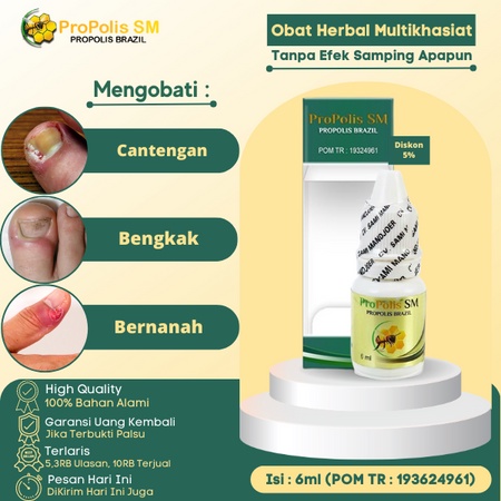 Obat Oles Kuku Cantengan, obat cantengan jempol kaki, Obat Jempol Kuku Kaki Tangan Bengkak Bernanah,