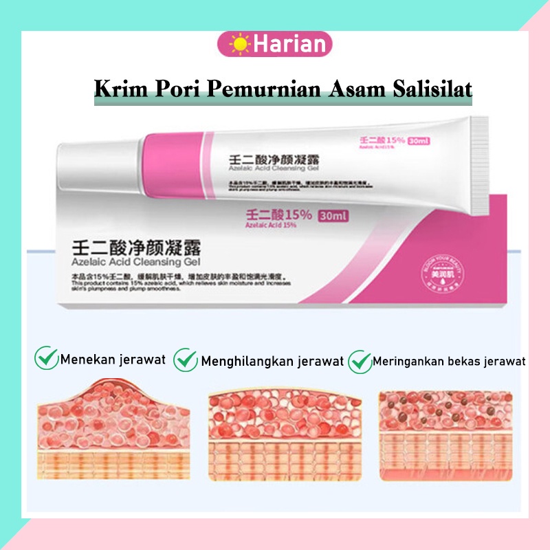 Acne gel jerawat Mengecilkan Pori pori besar Serum wajah 30G Menyegarkan kontrol minyak komedo mengecilkan pori-pori Meningkatkan jerawat dan kulit kasar Melembabkan dan meremajakan Menghilangkan jerawat, komedo, pori-pori besar