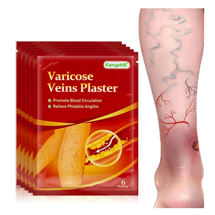 Koyo Penghilang Varises Paling Ampuh Varicose Veins Plaster Original 1pack Isi 6pcs