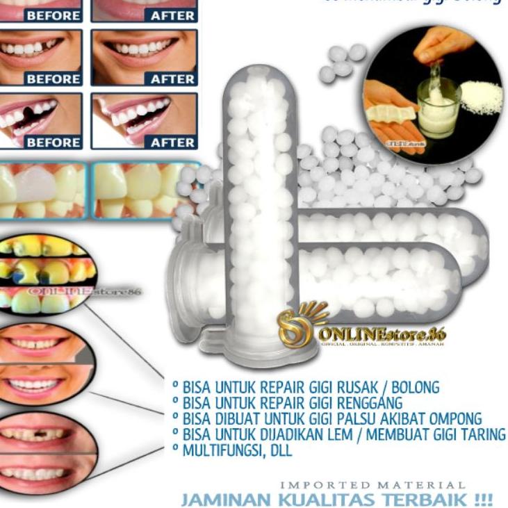 ★ TEMPTOOTH TEMPORARY DIY TOOTH Lem Penambal Gigi Rusak Gel Gigi Buat Tambal lubang Retak Renggang b
