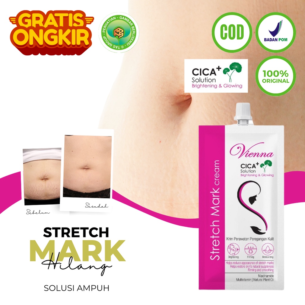 Penghilang Bekas Luka - Scr Penghilang Bekas Luka Strechmark Vienna Stretch Mark Cream