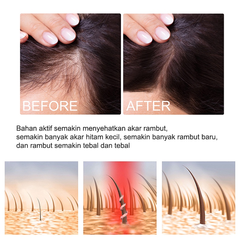 Ginge Esensi Semprotan jahe Ginger Hair Growth Essence 30ml Hair Oil Serum Rambut Anti Rontok Mempercepat Pertumbuhan Rambut Botak Rontok germinal rambut Perawatan