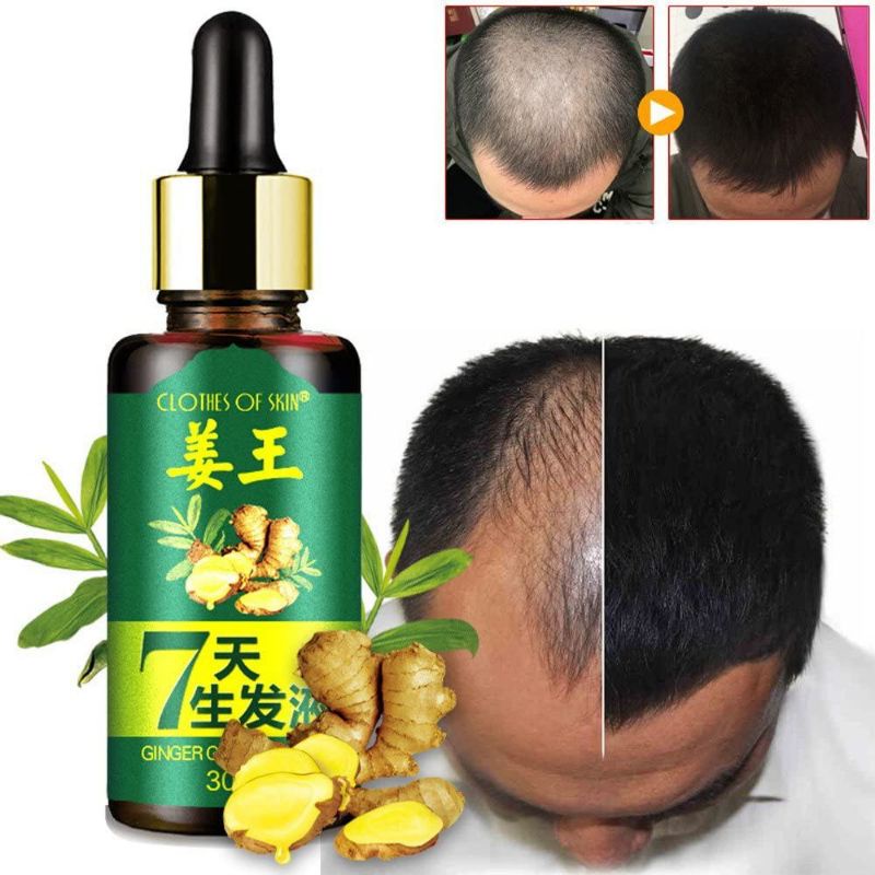 Obat Penumbuh Rambut Anti Rontok Botak Ginger Oil 7 Days Aman Penumbuh Rambut Botak