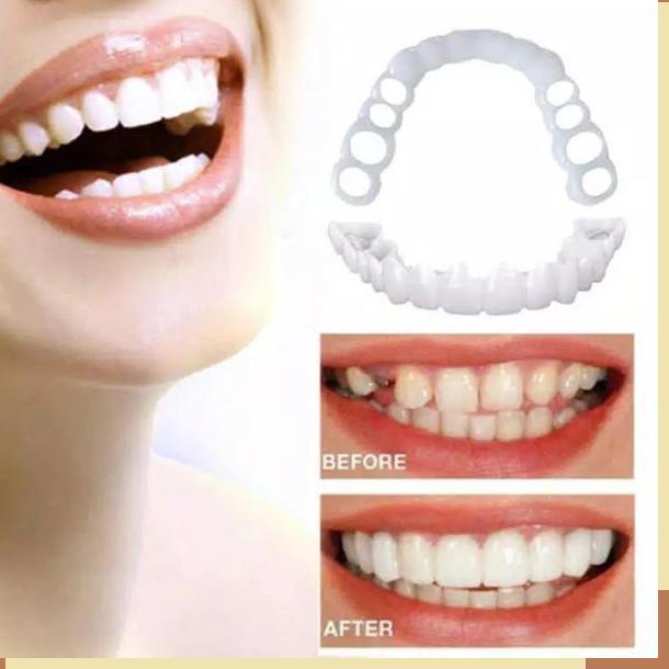 1 SET GIGI PALSU INSTAN ATAS BAWAH GIGI PALSU ATAS BAWAH SEPASANG TARING PENUTUP OMPONG LEPAS PASANG