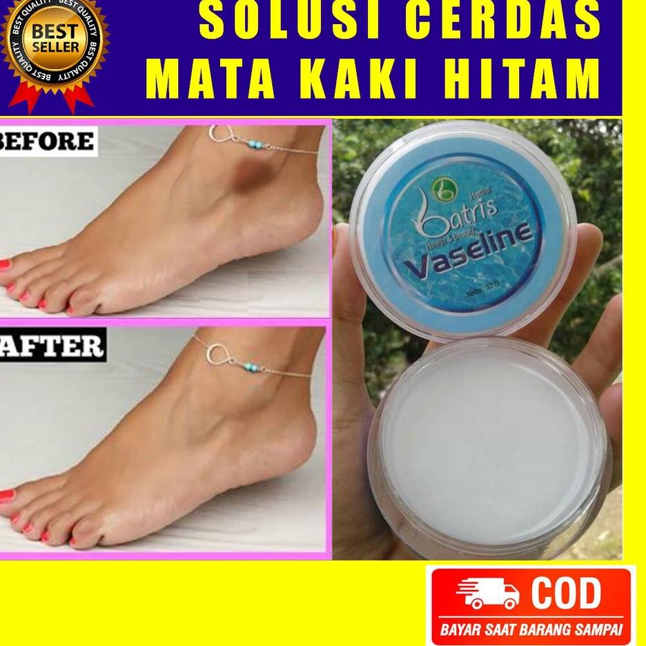 Promo Salep Obat Mata Kaki Hitam Kapalan Kering Ampuh Tanpa Efek Samping Panas Perih Iritasi