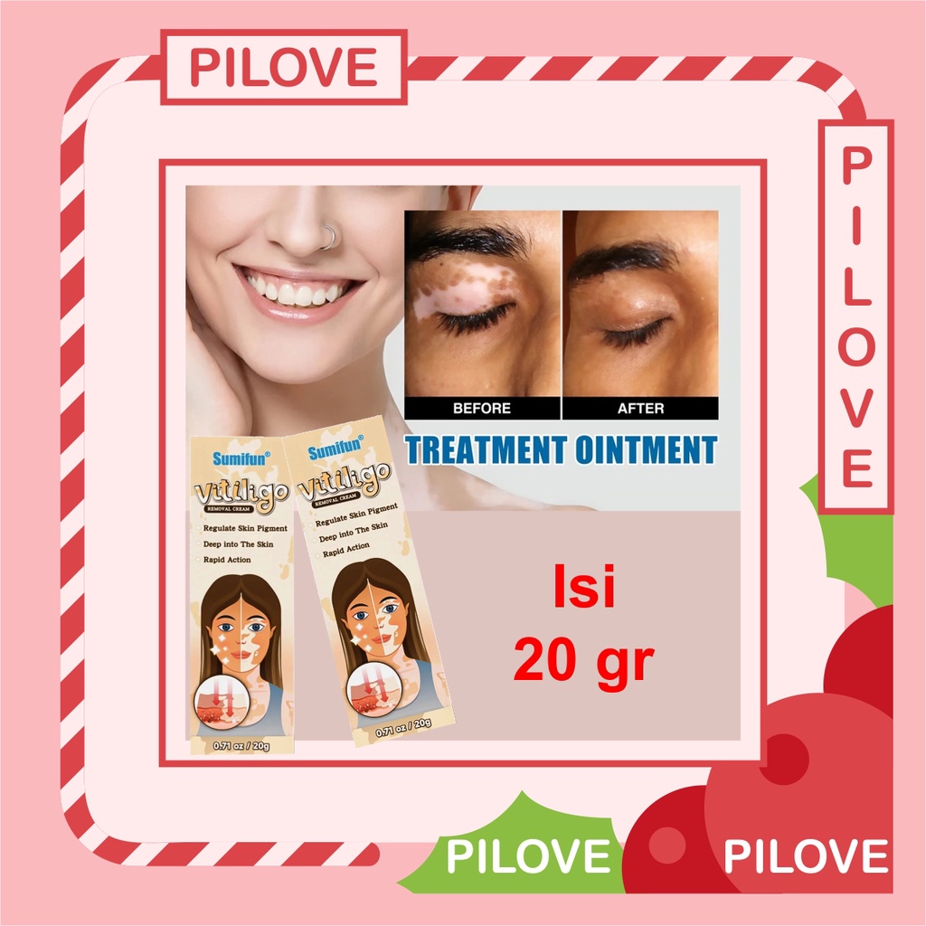 PILOVE - Cream Krim Obat Penghilang Penyembuh Vitiligo Salep Krim Cream Vitiligo Treatment Kulit Bercak Belang Bintik Putih di Bibir Wajah Original Paling Ampuh 100%