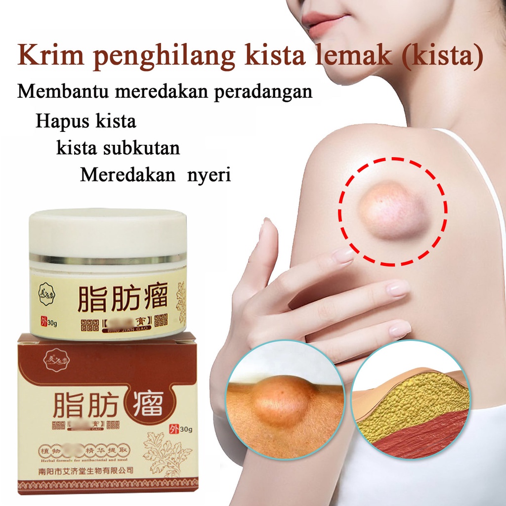 Obat benjolan Obat Benjolan lipoma Benjolan di Leher Benjolan Di Tangan Benjolan Di Ketiak Benjolan Di Punggung Pundak Benjolan Di Kaki Selangkangan Telinga Gondok Hipertiroid Kelenjar Tiroid Limfoma Limpoma Lipoma Kelenjar Herbal 30g