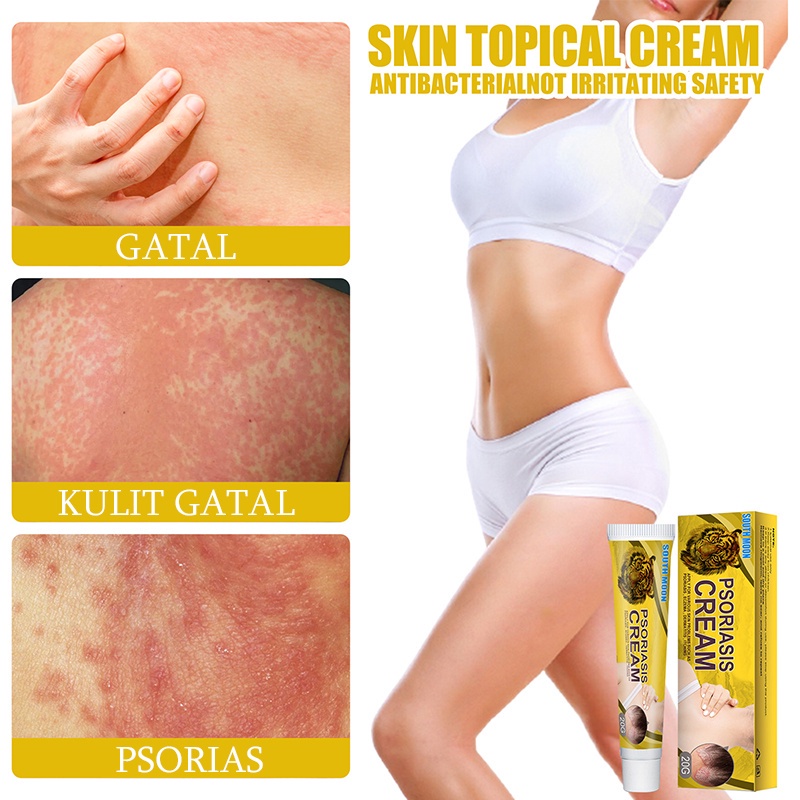 Salep gatal Salep Eksim Salep kulit Krim psoriasis paling ampuh Kulit Kepala Psoriasis Tangan Tinea Kaki Bau Versicolor Menghambat Dermatitis Jamur Anti Gatal Cream 20g