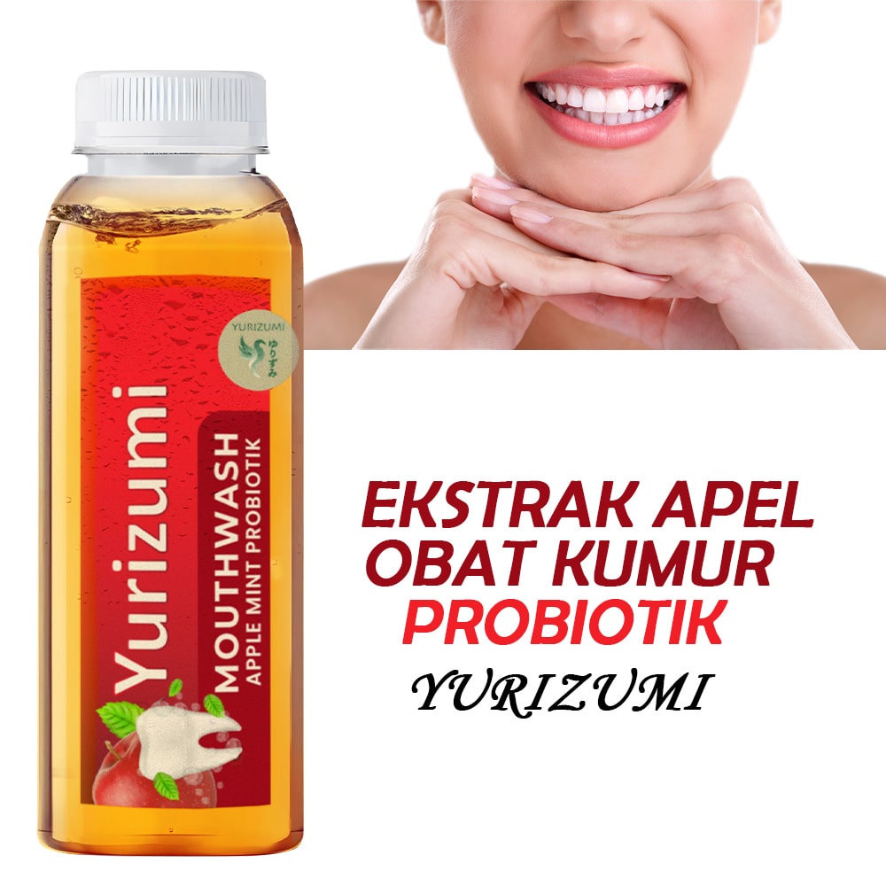 Hope Store - Yurizumi Apple Mint Obat Kumur Probiotik Fresh Mint Mouthwash Perontok Karang Gigi dan Plak