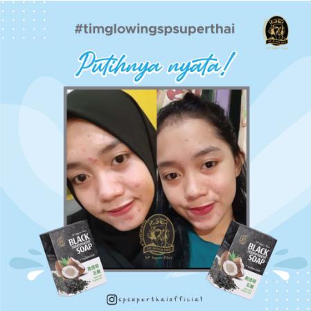 ^ KYRA ^ SP Super Thai Sabun Mandi Batang Papaya Matcha Black Soap Thailand