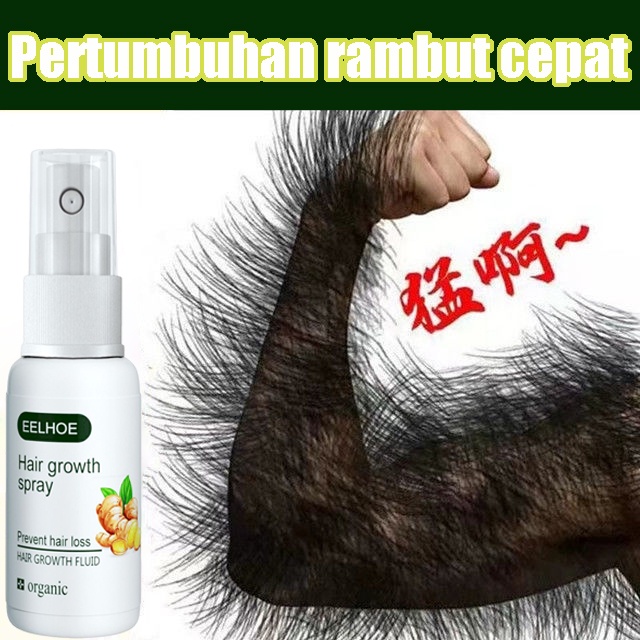 Ginge Esensi Semprotan jahe Ginger Hair Growth Essence 30ml Hair Oil Serum Rambut Anti Rontok Mempercepat Pertumbuhan Rambut Botak Rontok germinal rambut Perawatan