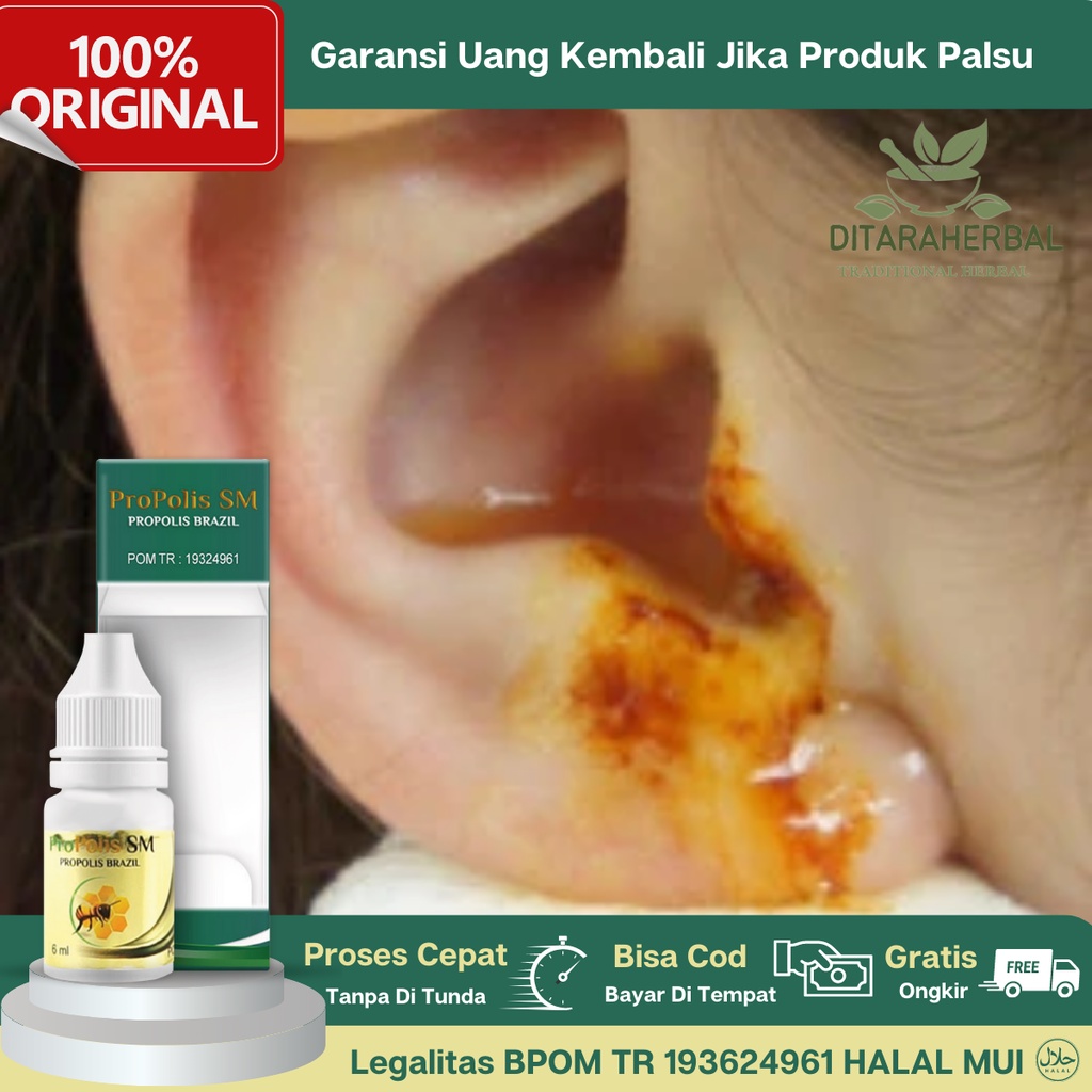 Obat Telinga Congek, Obat Tetes Telinga Congek, Obat Telinga Berair, Obat Telinga Bau, Obat Telinga 