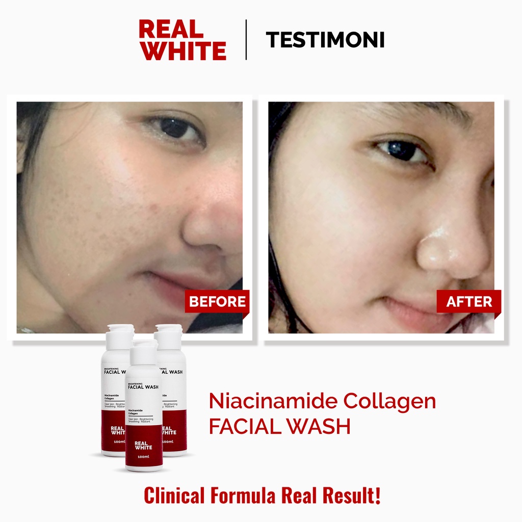 ⭐BAGUS⭐ REAL WHITE Niacinamide Collagen Face Wash 100ML | Sabun Cuci Muka Cleanser