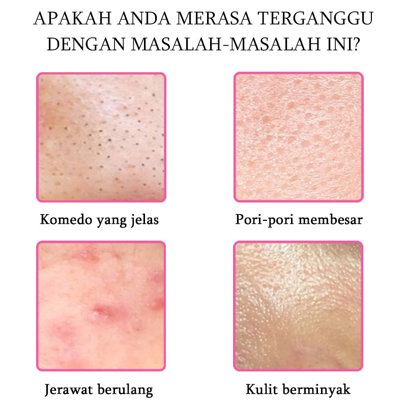 Mengecilkan Pori pori besar Serum wajah Acne gel jerawat 30G Menyegarkan kontrol minyak komedo mengecilkan pori-pori Meningkatkan jerawat dan kulit kasar Melembabkan dan meremajakan Menghilangkan jerawat, komedo, pori-pori besar