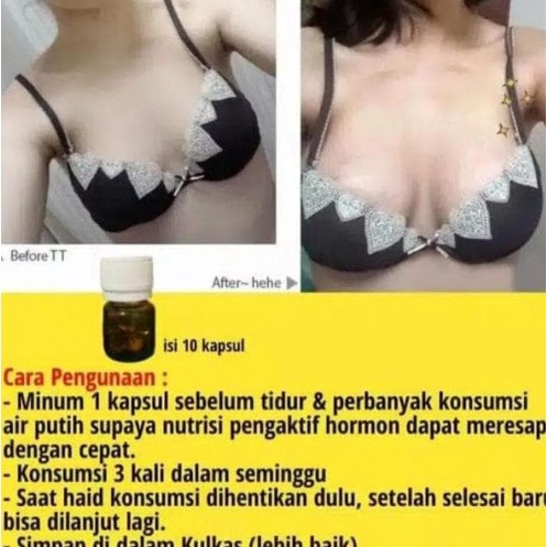 Softgel Hormon Estrogen Payudara