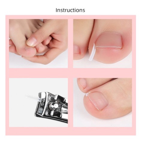 1pcs Bantalan Silikon koreksi Kuku Ingrown Nail Isolation Pad kuku