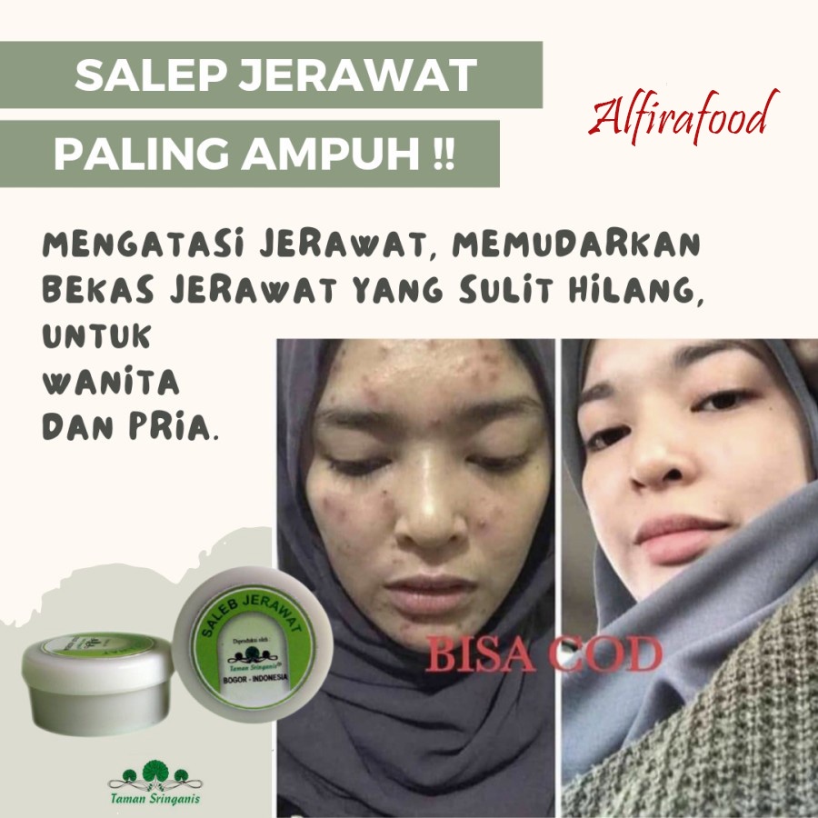 Taman Sringanis Salep Jerawat dan Bekas Jerawat 100% Herbal Salep Antanan
