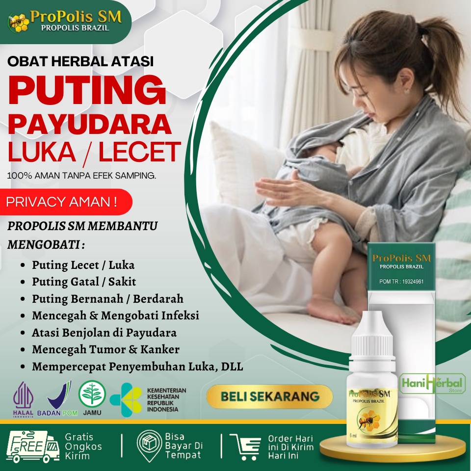 OBAT PUTING LECET AKIBAT GIGITAN BAYI - OBAT PUTING LECET SAAT MENYUSUI - OBAT PUTING LECET YANG AMA