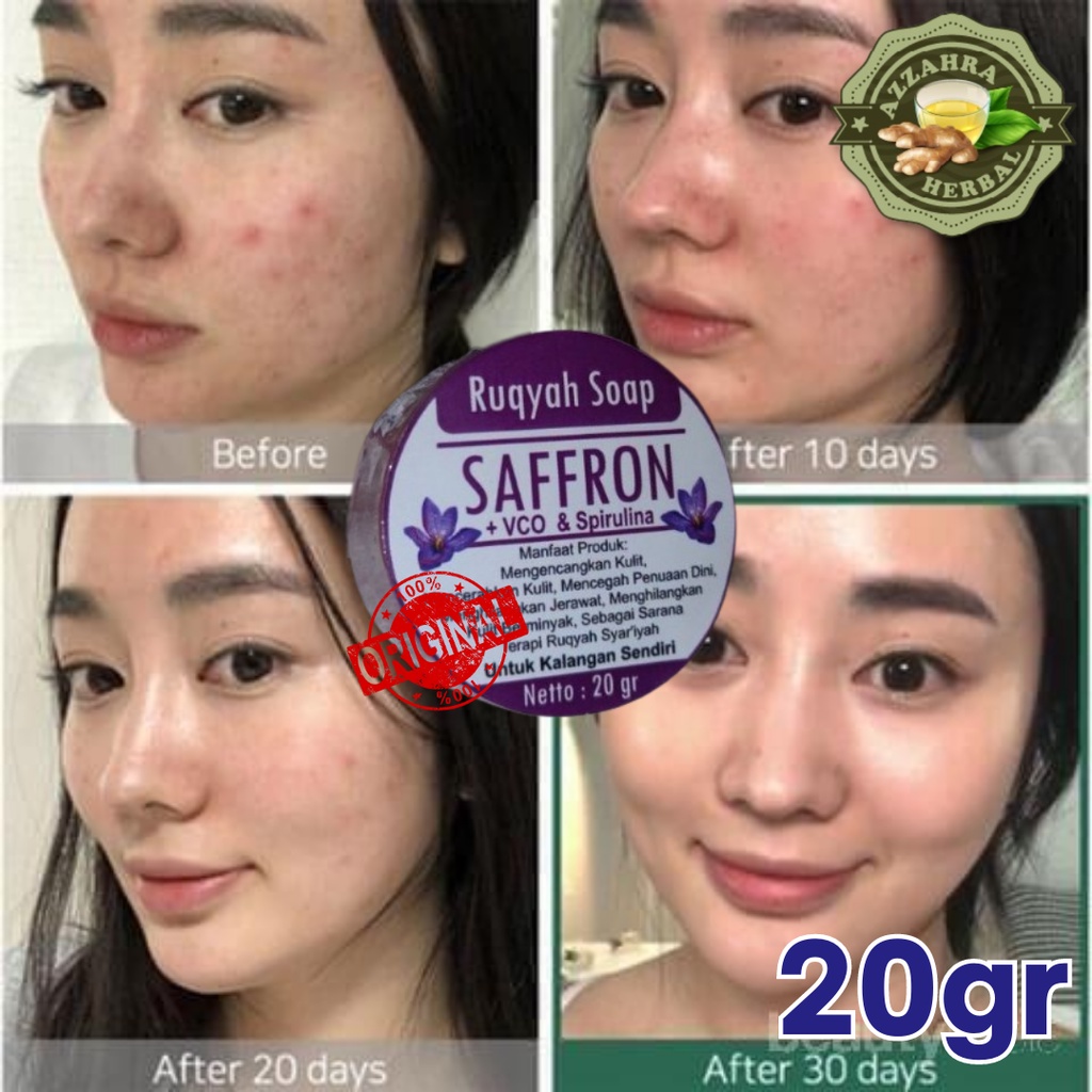 Sabun Saffron Penghilang Jerawat Pemutih Wajah Alami VCO Spirulina Scars Bekas Luka Noda Hitam