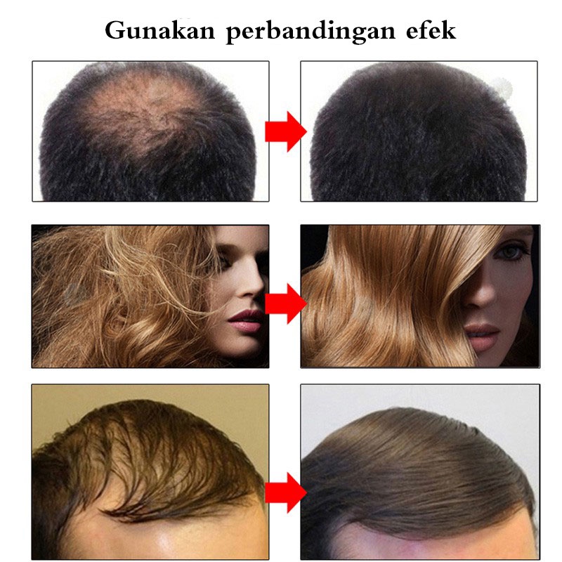 Vitamin rambut rontok Serum rambut rontok Hair tonic rambut rontok Perawatan rambut rontok 30ml Efektif membantu menumbuhkan/menguatkan rambut untuk mencegah kerontokan/membantu rambut menjadi lebih gelap dan cerah