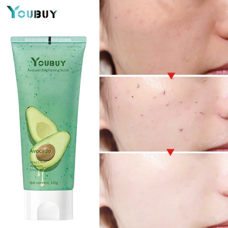 YOUBUY Avocado Face Exfoliating Cream Skin Care Whitening Moisturizer Facial Scrub Cleaner Acne Blackhead Treatment Remove