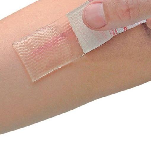 ♣ Cica-Care Silicone Gel untuk Keloid ➼