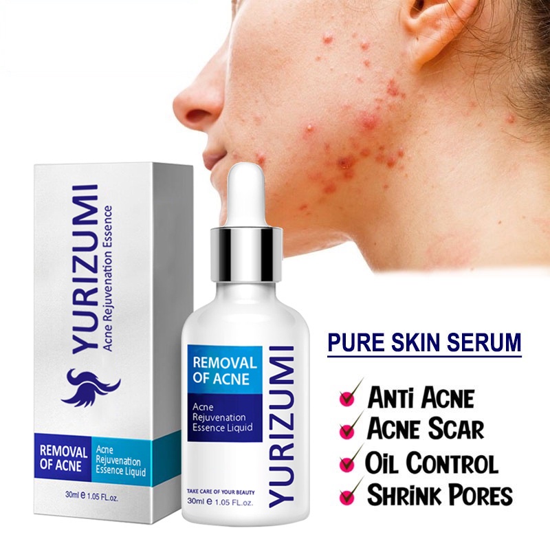 [ PAKET 2IN1 ] Yurizumi Acne Pure Skin Cream Obat Jerawat Paling Ampuh Menghilangkan Jerawat