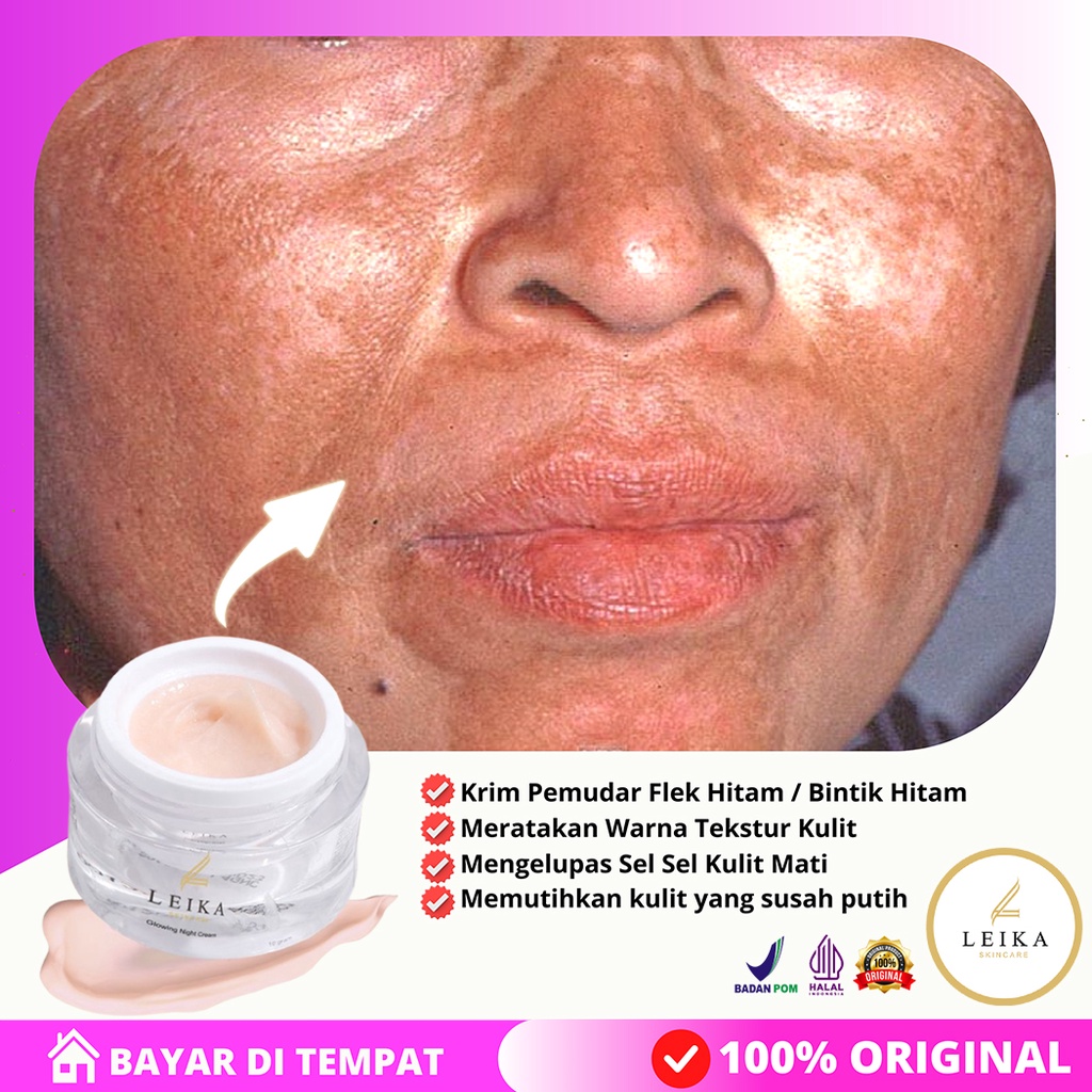 CREAM FLEK TEBAL DAN SERUM PENGHILANG FLEK TEBAL DAN BANDEL SALEP FLEK AMPUH SALEP FLEK NIGHT SALEP 