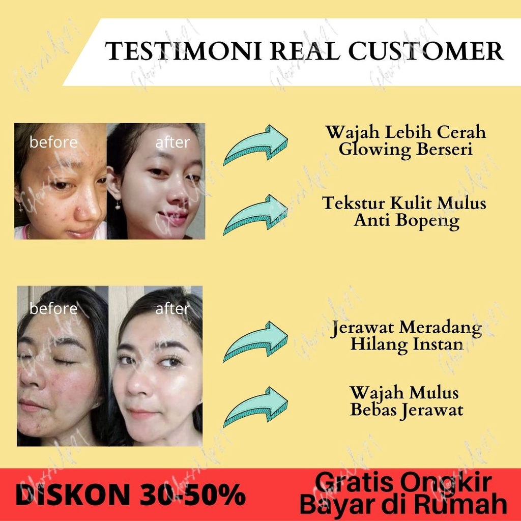 HANASUI ACNE TREATMENT GENTLE CLEANSER 60GR - SABUN WAJAH HANASUI ACNE