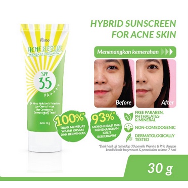 FANBO Acne Rescue Water Gel Sunscreen SPF 35 PA+++