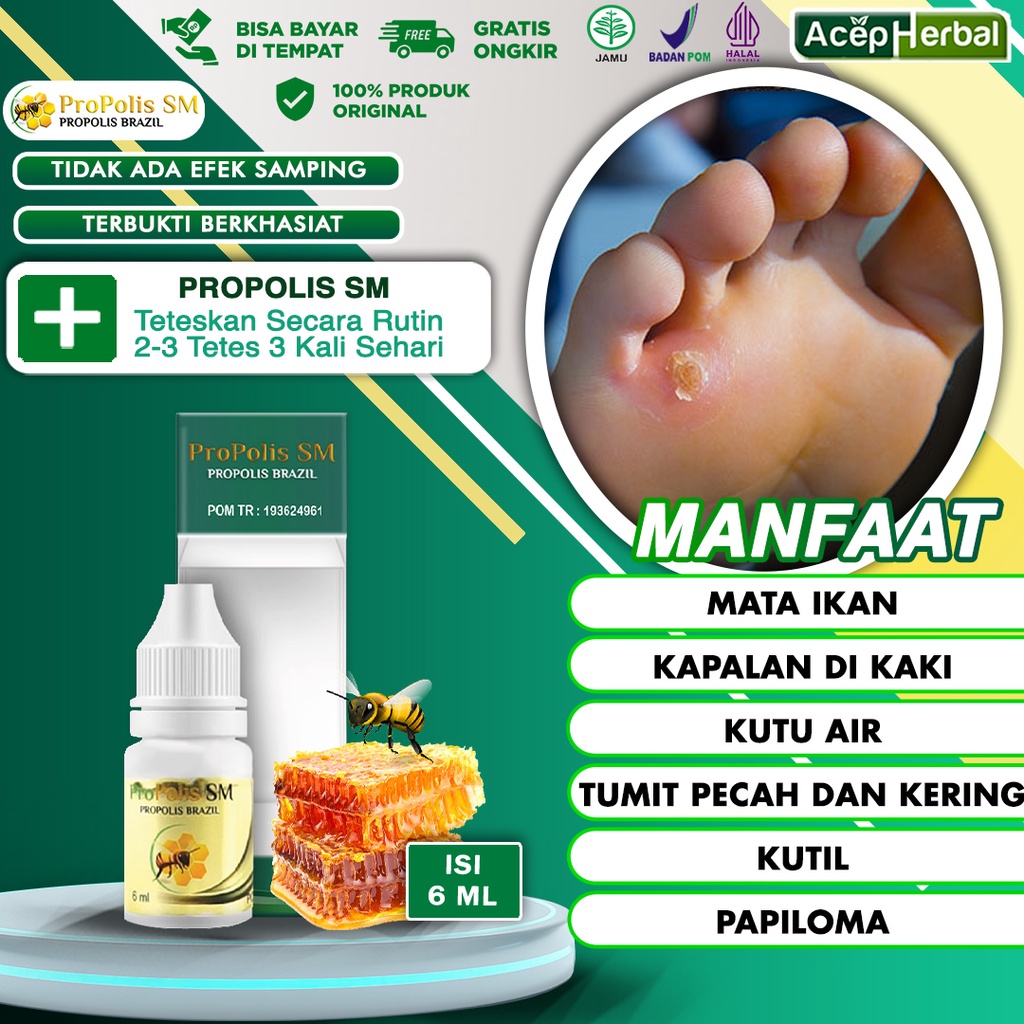 Obat Penghilang Mata Ikan Pada Kaki Kapalan Salep Kutu Air Tumit Pecah Dan Kering Bekas Luka Hitam K