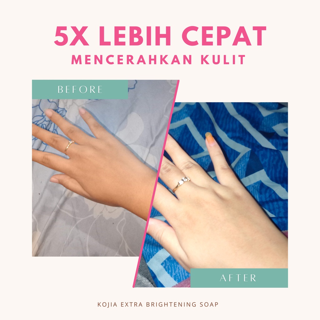 Kojia - Extra Brightening Soap | Sabun Pencerah Pemutih Badan Wajah Permanen Ampuh BPOM by rempahgadis