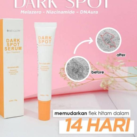 Termurah dan terbaik MS GLOW DARK SPOT SERUM / DARK SPOT MS GLOW / DARK SPOT / MS GLOW buruan