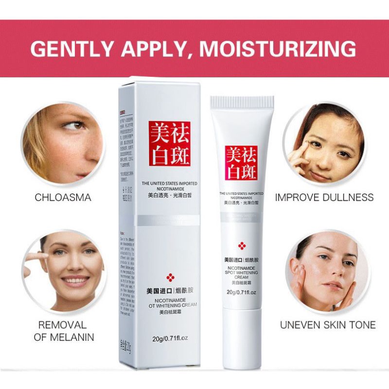 Youbuy whitening freckle cream remove dark spots anti freckle cream niacinamide fade